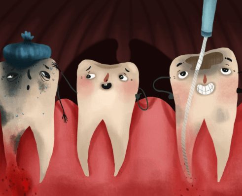 Average Cost of a Root Canal